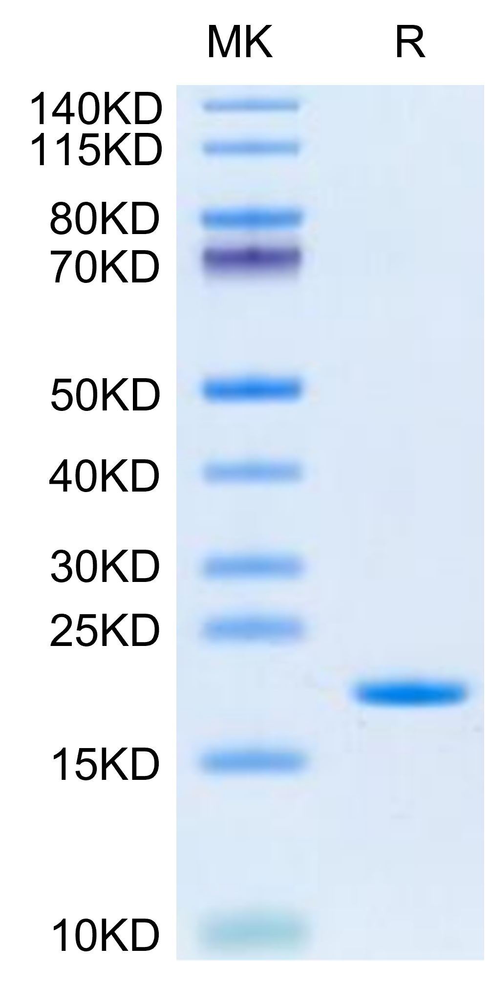 Human IL-13 Protein (IL1-HM013) - Image 5